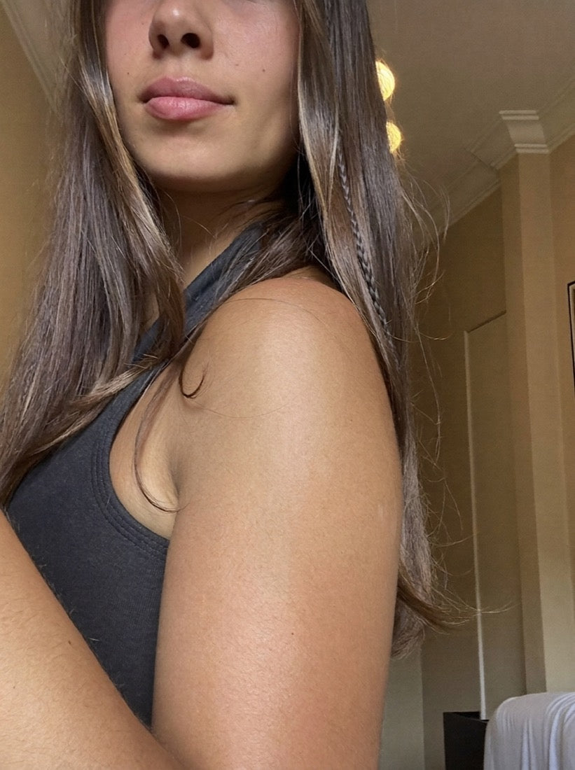 Skin after TRIHARD