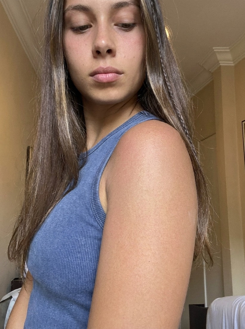 Skin before TRIHARD